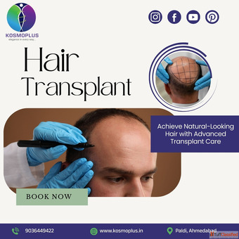 Restore Your Hairline with an Expert Hair Transplant in Ahmedabad