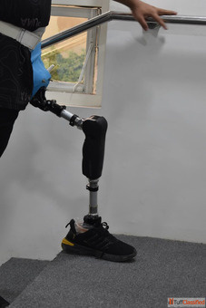 Best Artificial Leg in Hyderabad CareVale Prosthetics