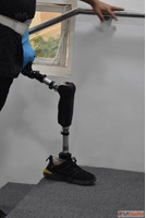 Best Artificial Leg in Hyderabad CareVale Prosthetics