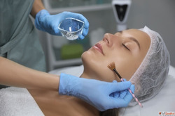 Chemical Peels for Pigmentation in Dubai A Complete Skin Rej...