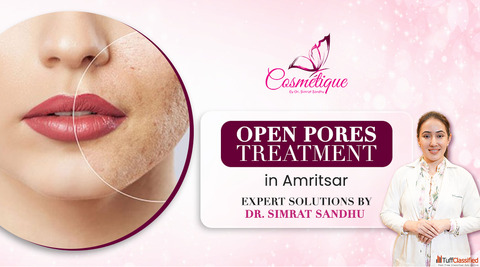 Open Pores Treatment in Amritsar Expert Skin Solutions by Dr. Simrat Sandhu