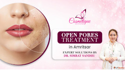 Open Pores Treatment in Amritsar Expert Skin Solutions by Dr...