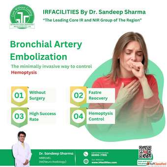Minimally Invasive Bronchial Artery Embolization