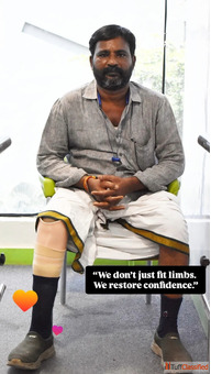 Best Artificial Leg in Hyderabad CareVale Prosthetics