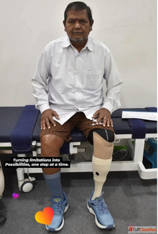 Best Artificial Leg in Hyderabad CareVale Prosthetics