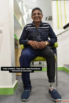 Best Artificial Leg in Hyderabad CareVale Prosthetics