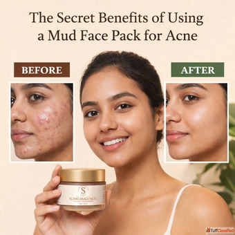 Buy Mud Face Pack for Acne - Say Goodbye to Pimples
