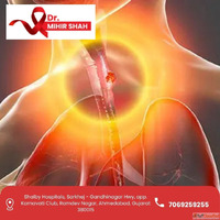 Top Esophageal Cancer Treatment in Ahmedabad - Dr Mihir Shah