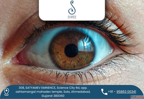Leading Eye Hospital for Refractive Surgery in Ahmedabad