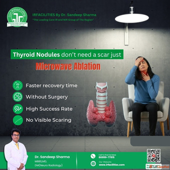 Advanced Thyroid Nodule Treatment Without Surgery