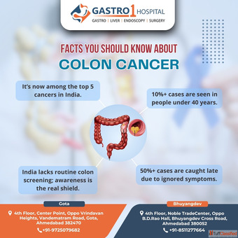 Trusted Center for Best Colon Cancer Treatment in Ahmedabad
