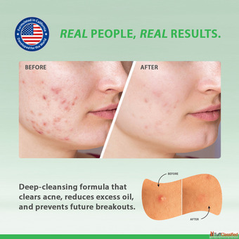 BHA Purging "Winter Sludge" Heavy Creams Cold Air Clogs