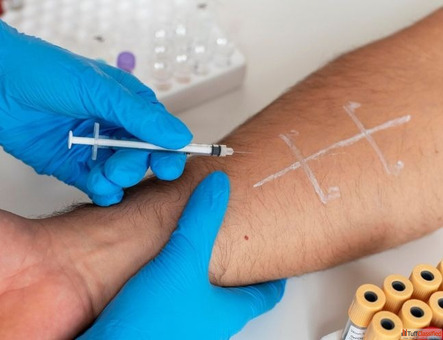 Minimally Invasive Surgery Clinic in Delhi Dr Akash Clinic