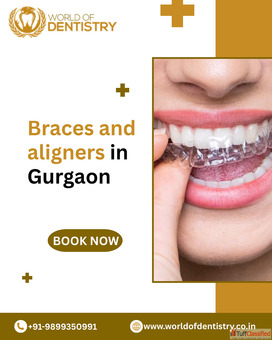 Braces and Aligners in Gurgaon - World of Dentistry