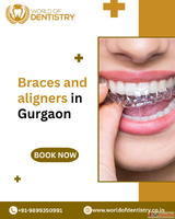 Braces and Aligners in Gurgaon - World of Dentistry