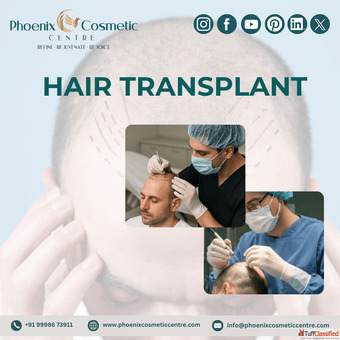 Trusted Hair Transplant Surgery in Ahmedabad for Natural Results
