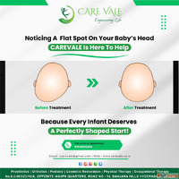 Best Artificial Leg in Hyderabad CareVale Prosthetics