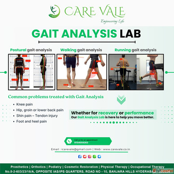 Best Artificial Leg in Hyderabad CareVale Prosthetics