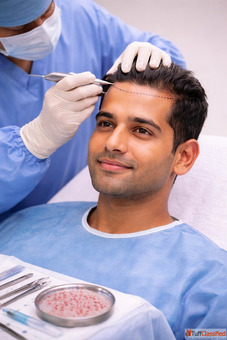 Best Hair Transplant Clinic in Balewadi - The Aesthetic Hub
