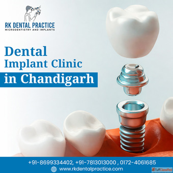 Best Dental Implant Clinic in Chandigarh