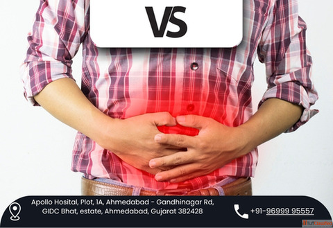 Consult Experienced Gastro Surgeon in Ahmedabad - Dr. Vishal Soni
