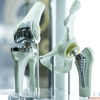 Trusted Revision Knee Hip Shoulder Replacement