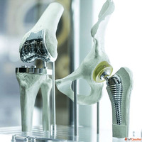 Trusted Revision Knee Hip Shoulder Replacement