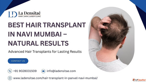 Best Hair Transplant in Navi Mumbai - Natural Results