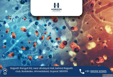 Dr. Bhavin Vadodariya - Skilled Cancer Surgeon in Ahmedabad