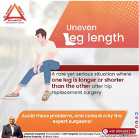 Robotic Hip Replacement Surgeon - Dr. Aashish Arbat Pune