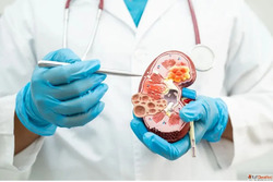 Nephrology Hospital in Ahmedabad