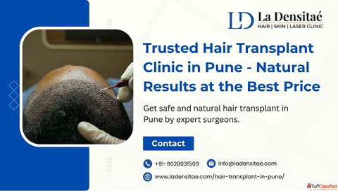 Trusted Hair Transplant Clinic in Pune Natural Results at the Best Price