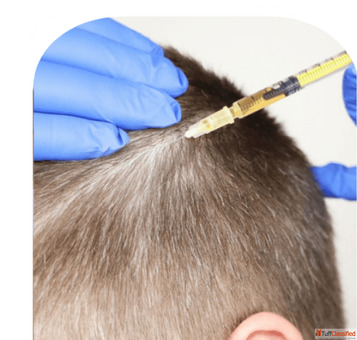 Expert Hair Loss Treatment and Transplant in Mumbai