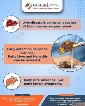 Safe and Effective Liver Treatment in Ahmedabad - Gastro1 Hospital