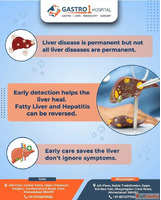 Safe and Effective Liver Treatment in Ahmedabad - Gastro1 Ho...