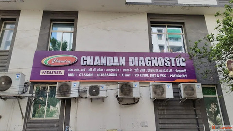 MRI cost in patna - Chandan Diagnostic Patna