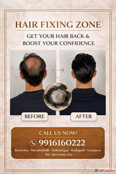 Bald spots don't define you. Confidence does -