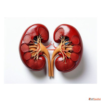 Kidney Stone Services in Delhi Laser Treatment Expert Care