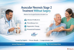 Avascular Necrosis Stage 2 Treatment Without Surgery - HipXp...