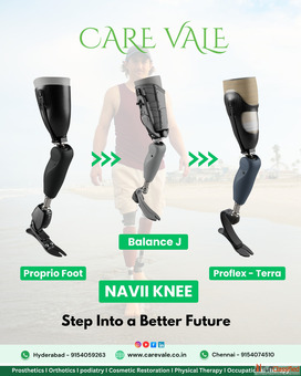 Best Artificial Leg in Hyderabad CareVale Prosthetics