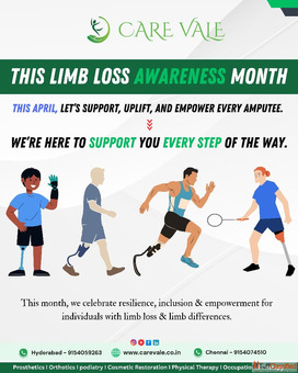 Best Artificial Leg in Hyderabad CareVale Prosthetics