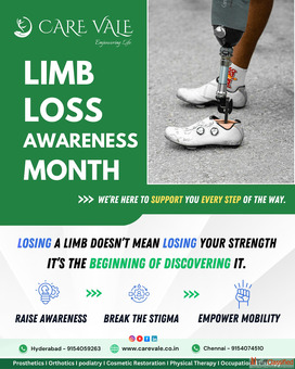 Best Artificial Leg in Hyderabad CareVale Prosthetics