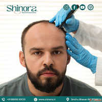 Shinora Clinic - Advanced Technology for Hair Transplant in ...