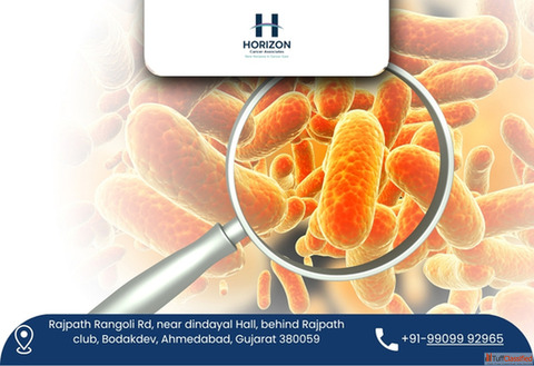 Experienced Hernia Surgeon in Ahmedabad for Fast Recovery