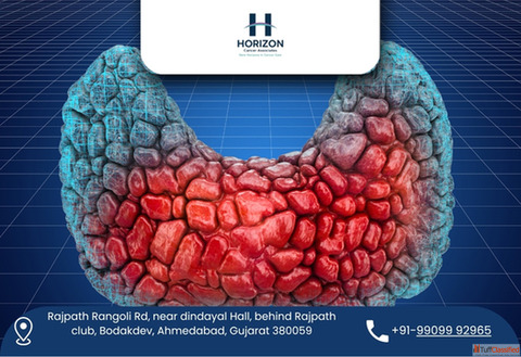 Experienced Hernia Surgeon in Ahmedabad for Fast Recovery