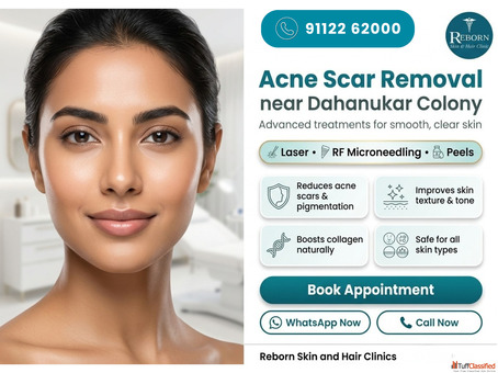 Acne Scar Removal near Dahanukar Colony