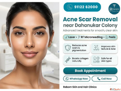 Acne Scar Removal near Dahanukar Colony