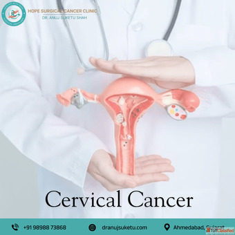 Cervical Cancer Doctor in Ahmedabad - Dr. Anuj Suketu Shah