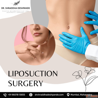 Fat Removal Liposuction Surgery in Mumbai Dr. Shraddha Deshpande