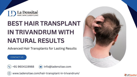 Best Hair Transplant in Trivandrum with Natural Results